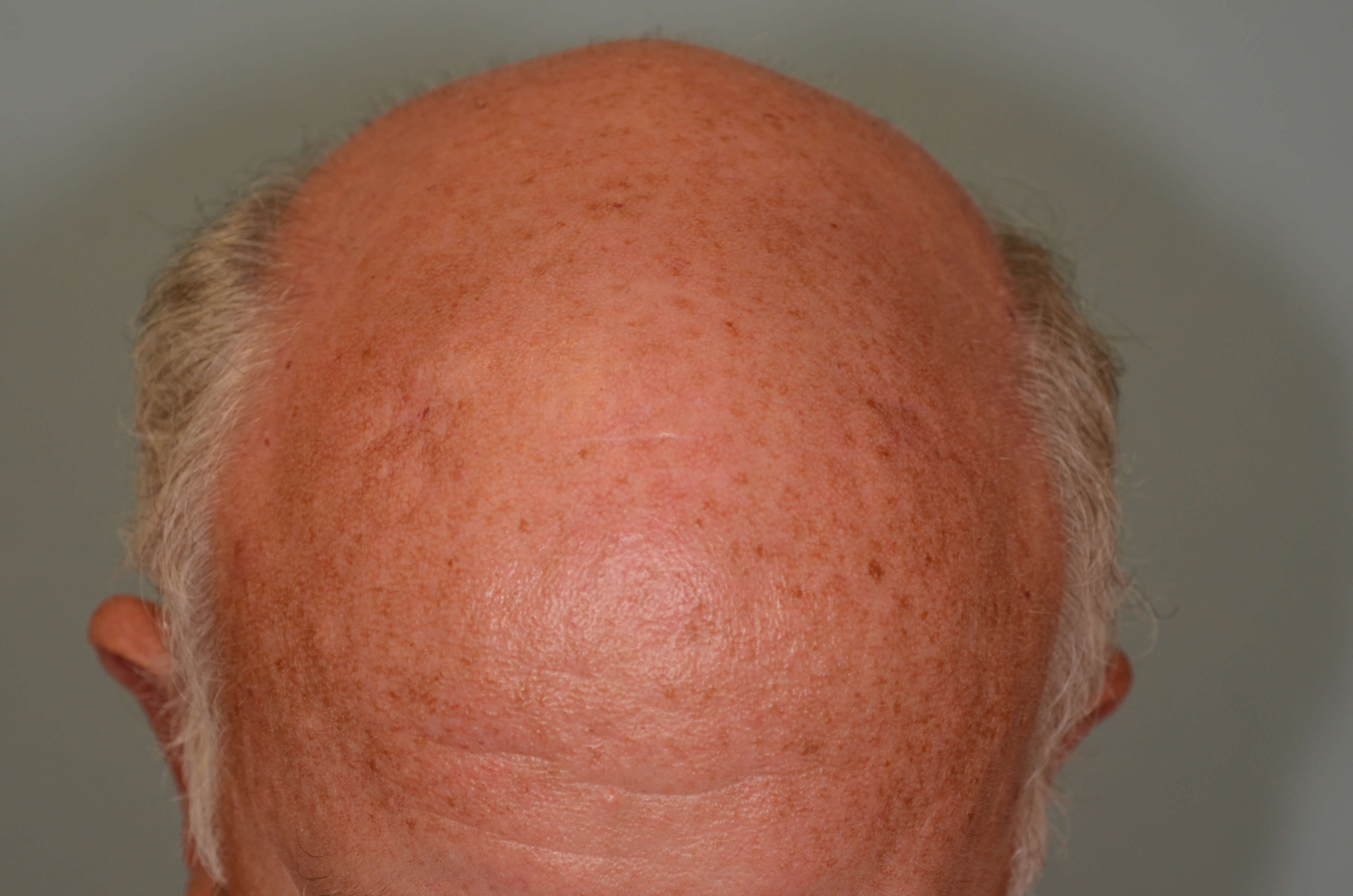 After Image
