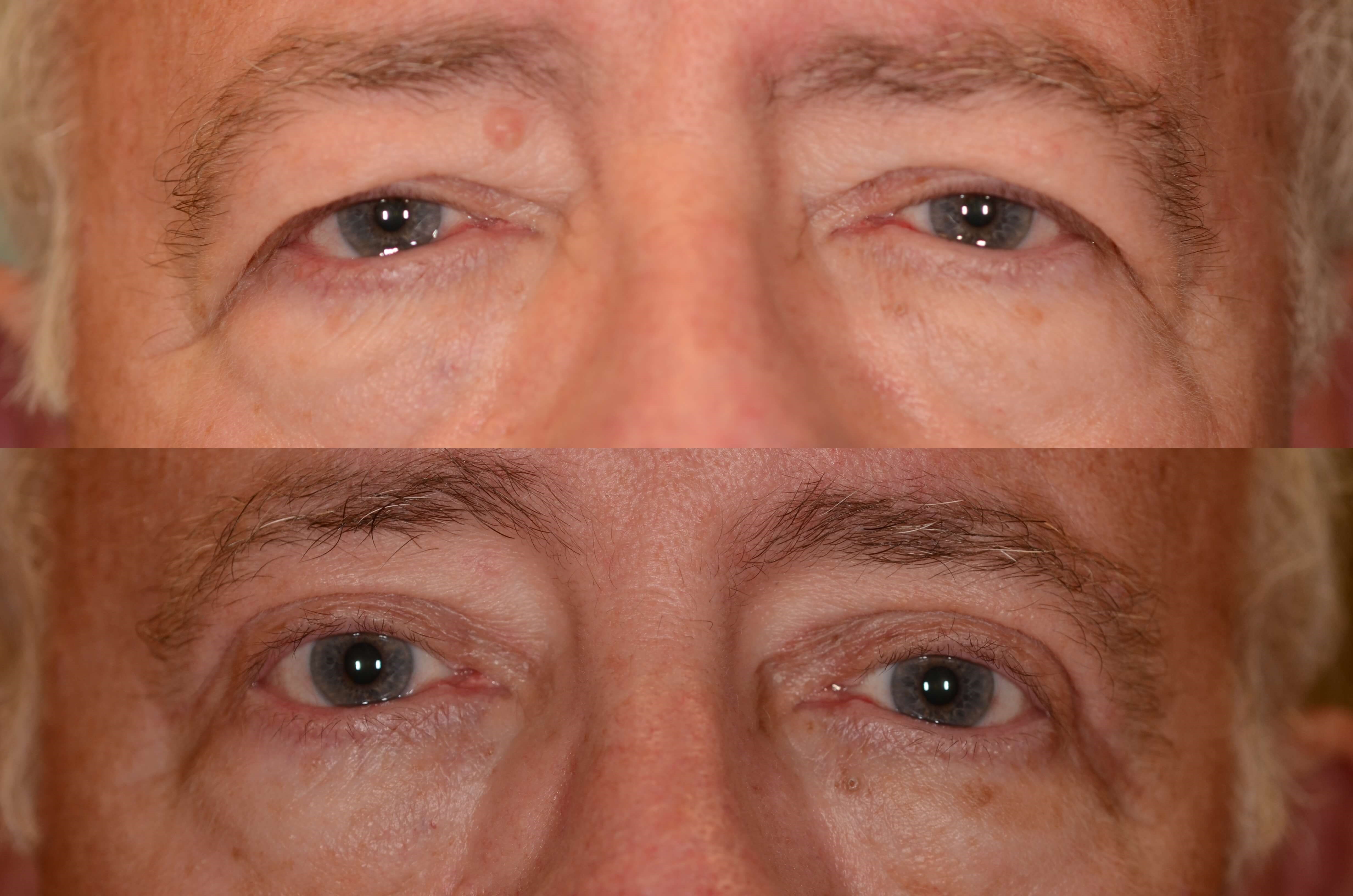 Looking more refreshed! Before and After