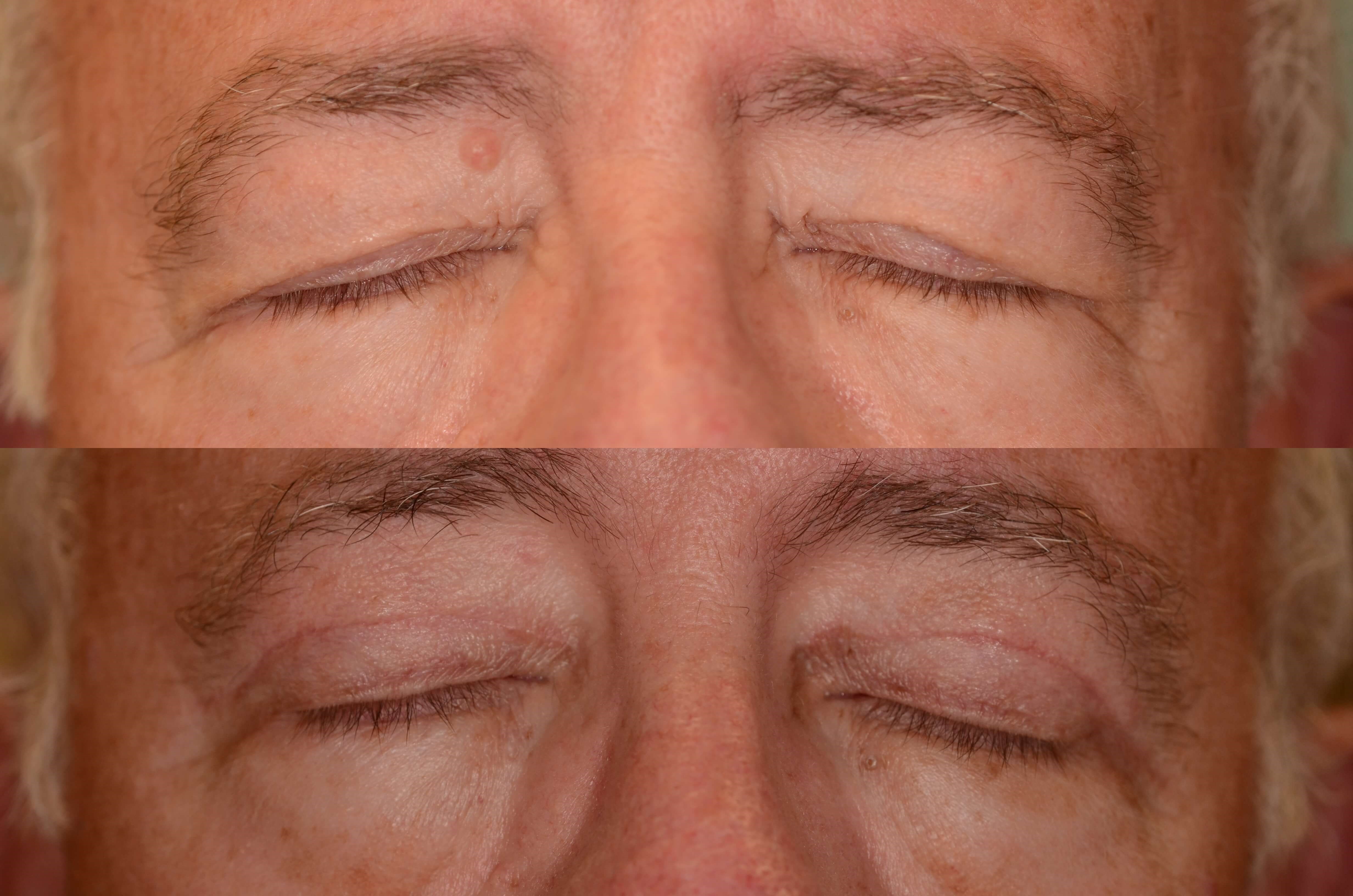 Looking more refreshed! Before and After