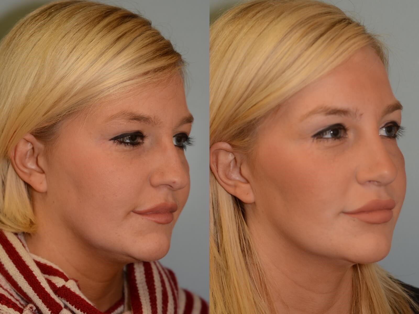 Her natural beauty enhanced Before and After