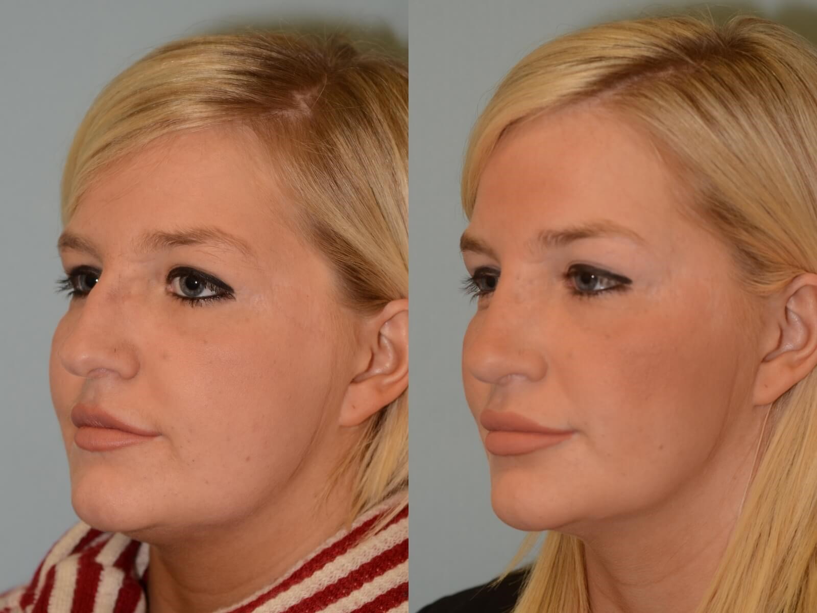 Her natural beauty enhanced Before and After