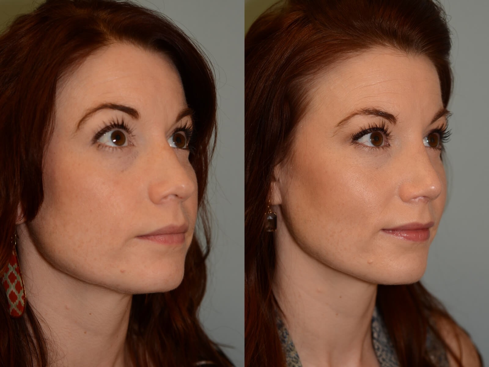 More fitting and feminine Before and After