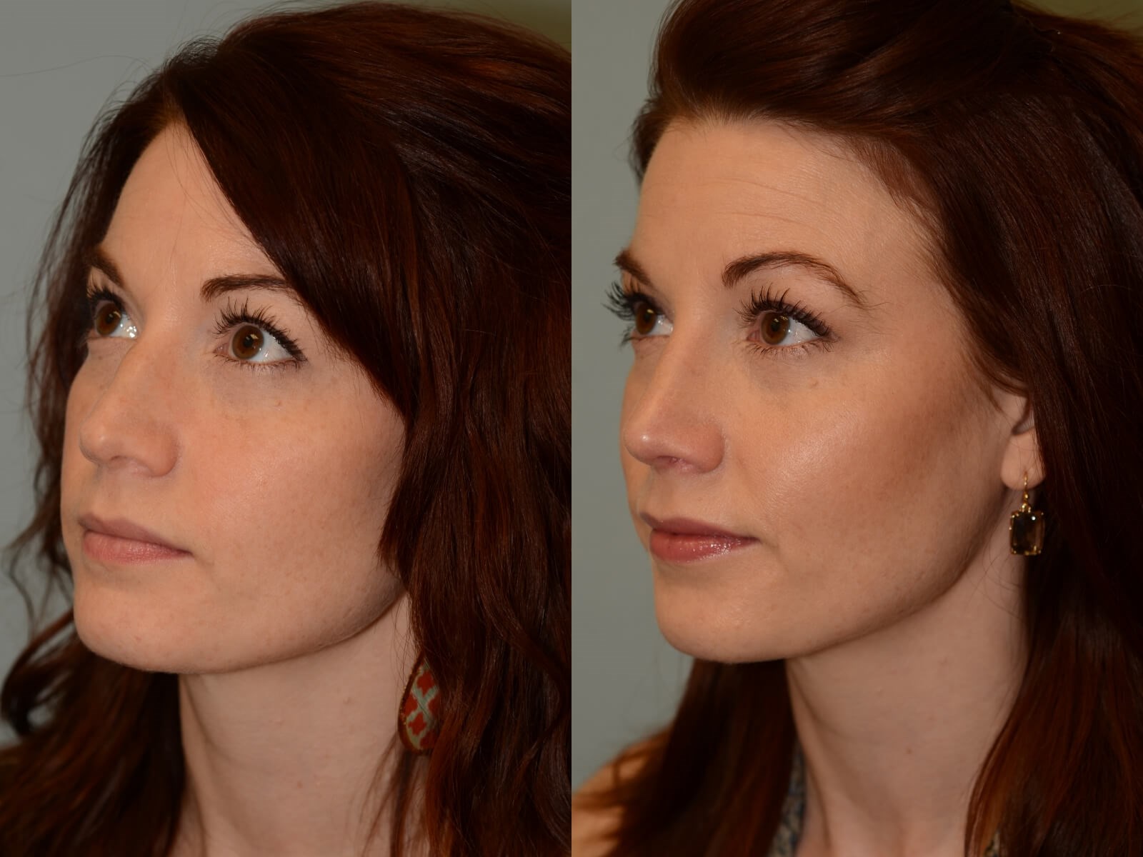 More fitting and feminine Before and After