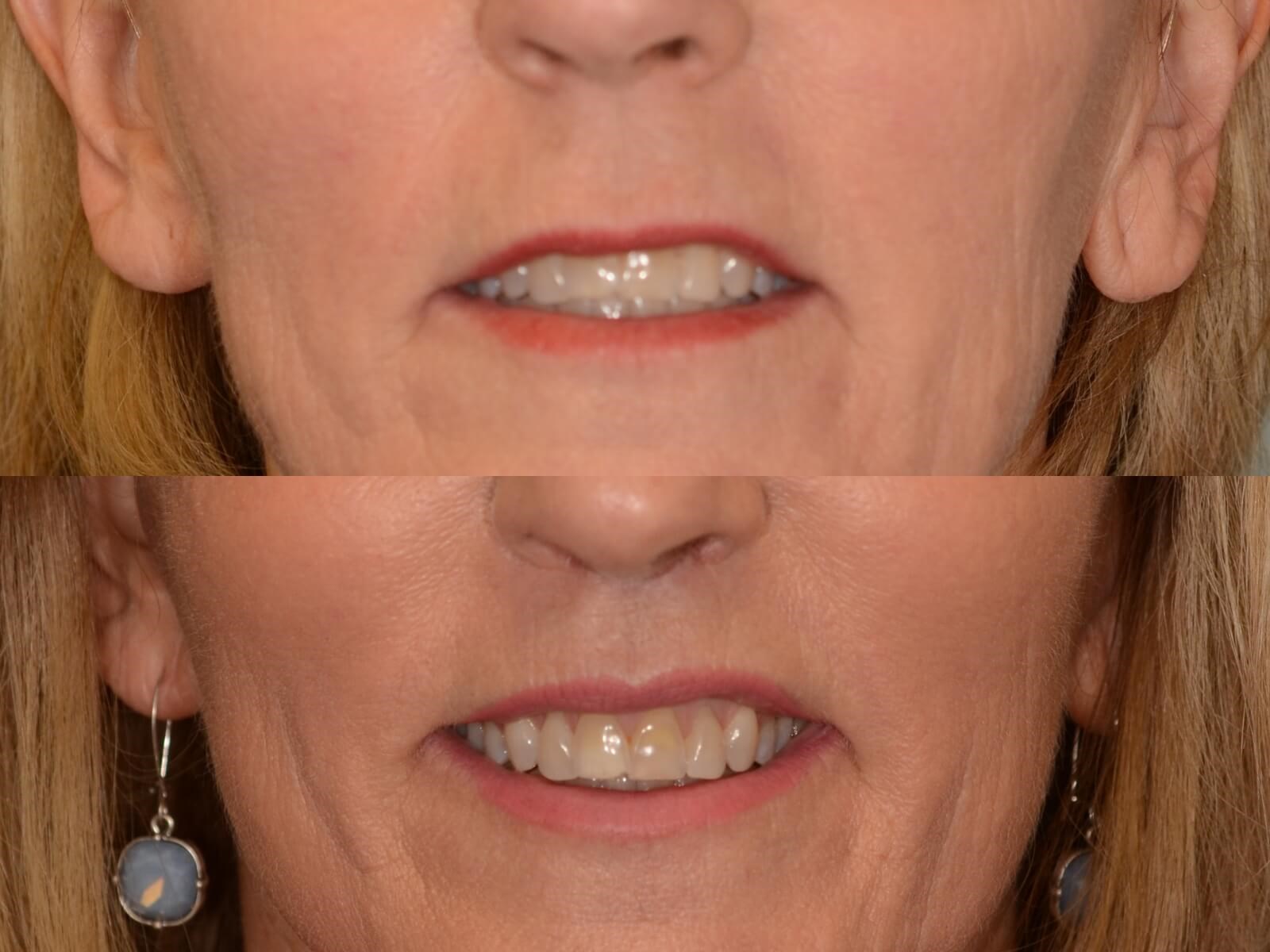 Beautiful Results Before and After