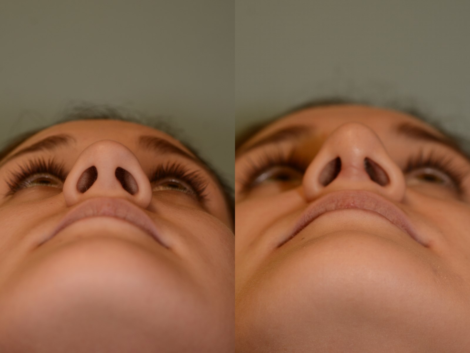 Function and Beauty Before and After