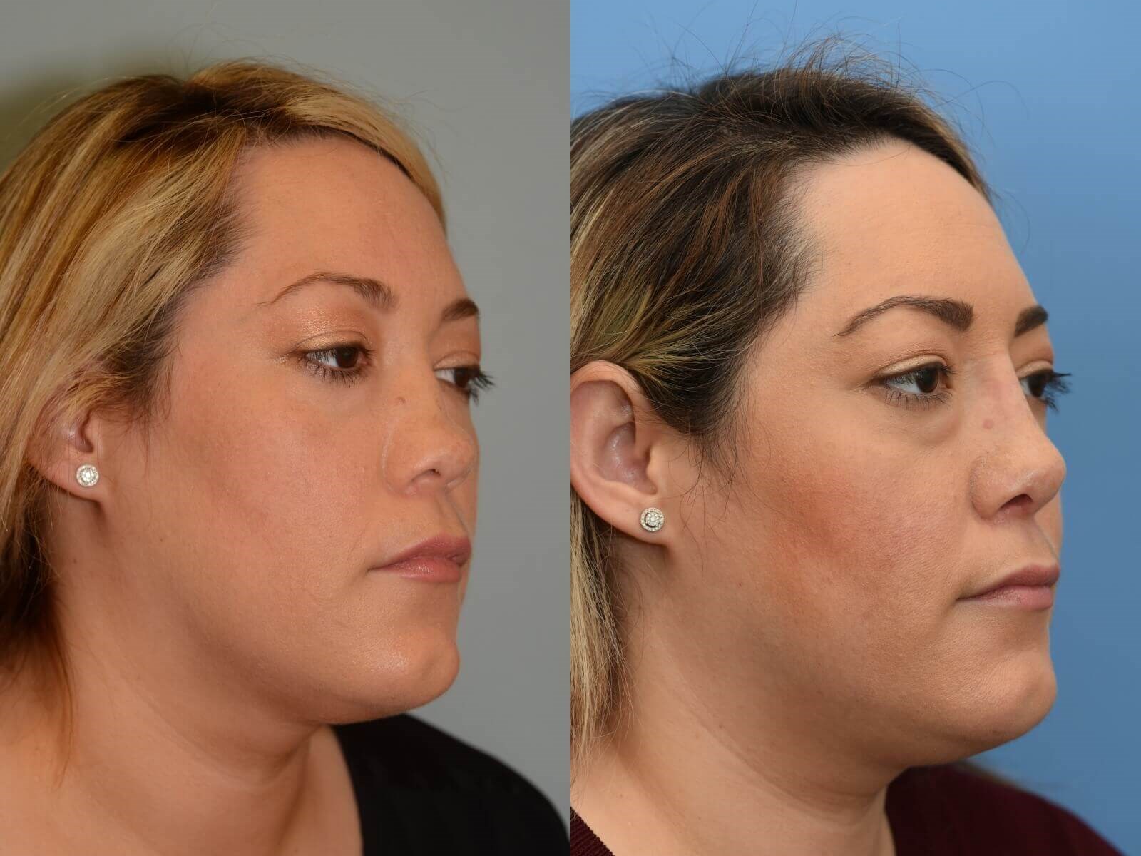 Beautiful to Breathe! Before and After