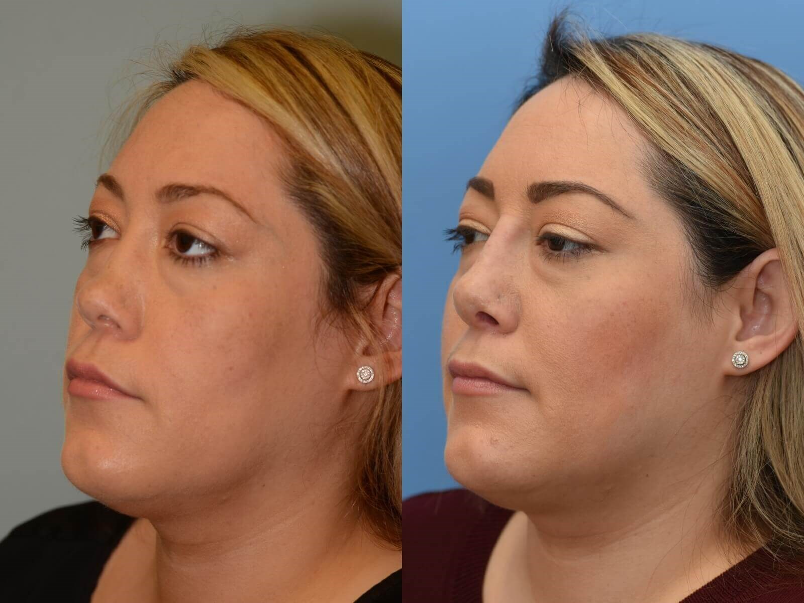 Beautiful to Breathe! Before and After