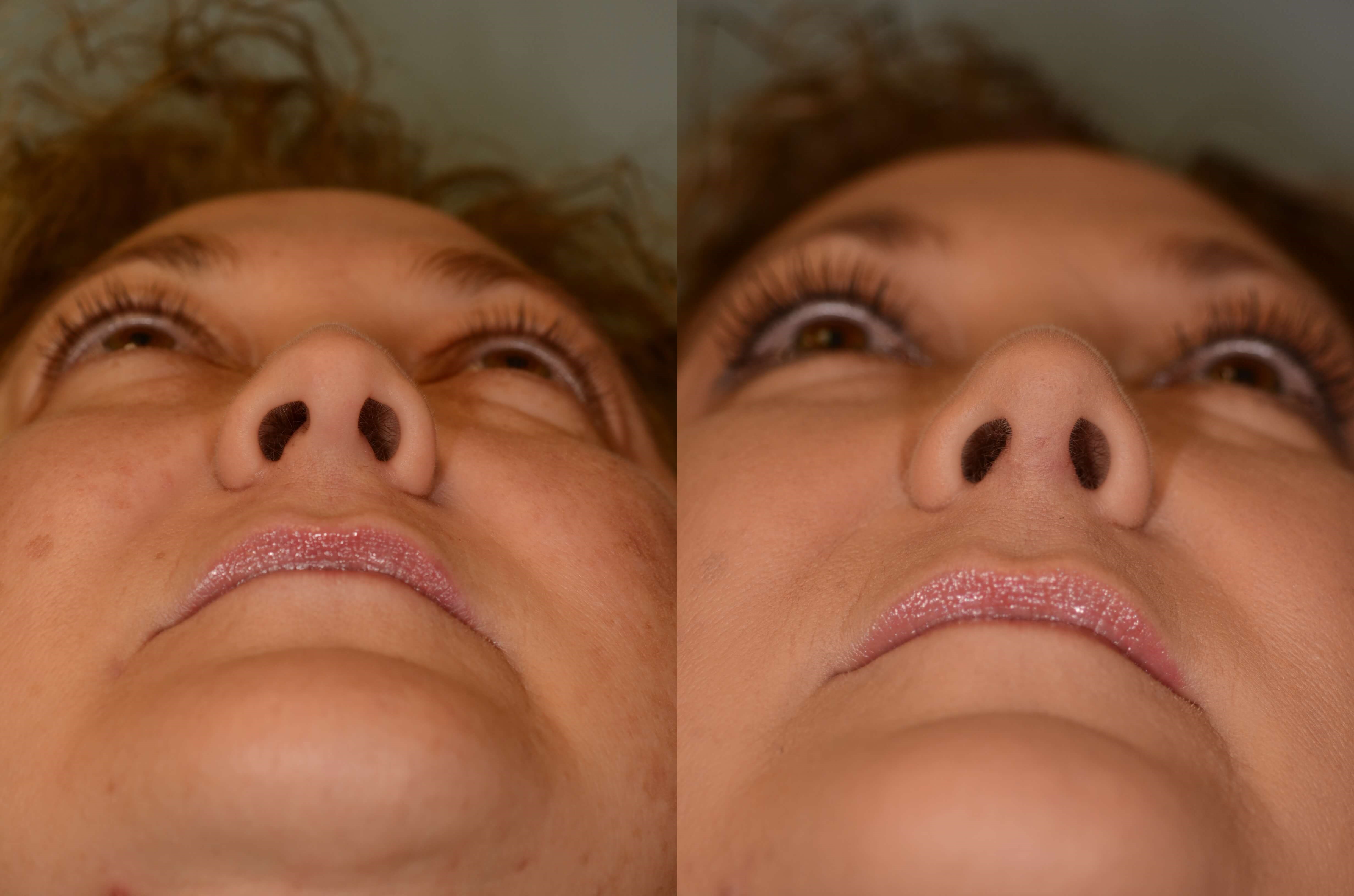 Refreshed and Renewed Before and After