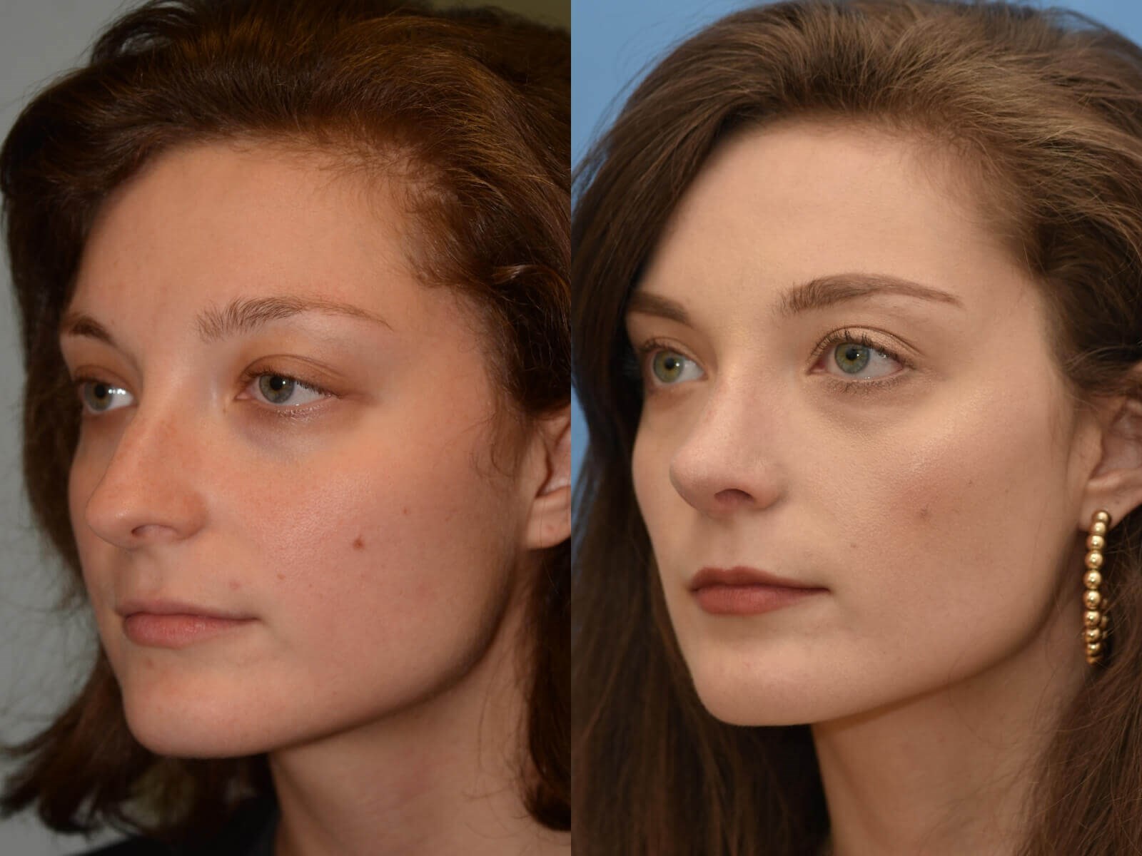 Breathing Beautifully Before and After