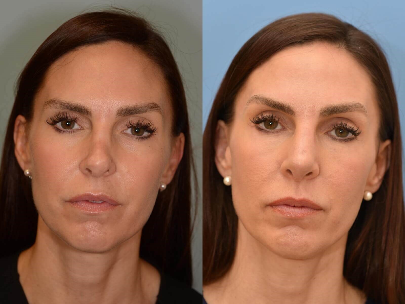 Breathing Beautifully! Before and After
