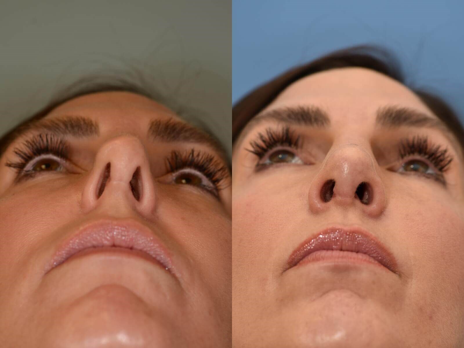 Breathing Beautifully! Before and After