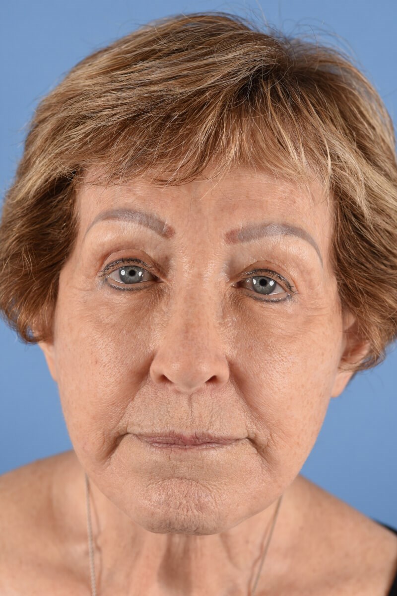 After Image